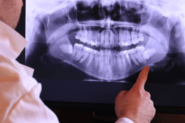 Best Emergency Treatment for Dental Infections or Abscesses in Asheville, NC