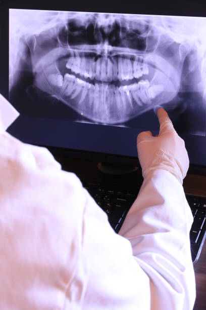 Best Emergency Dental Care for Broken or Chipped Teeth in Asheville, NC